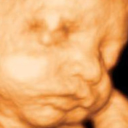ms preggo